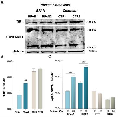 Ferrous Iron Up-regulation in Fibroblasts of Patients with Beta Propeller Protein-Associated Neurodegeneration (BPAN)